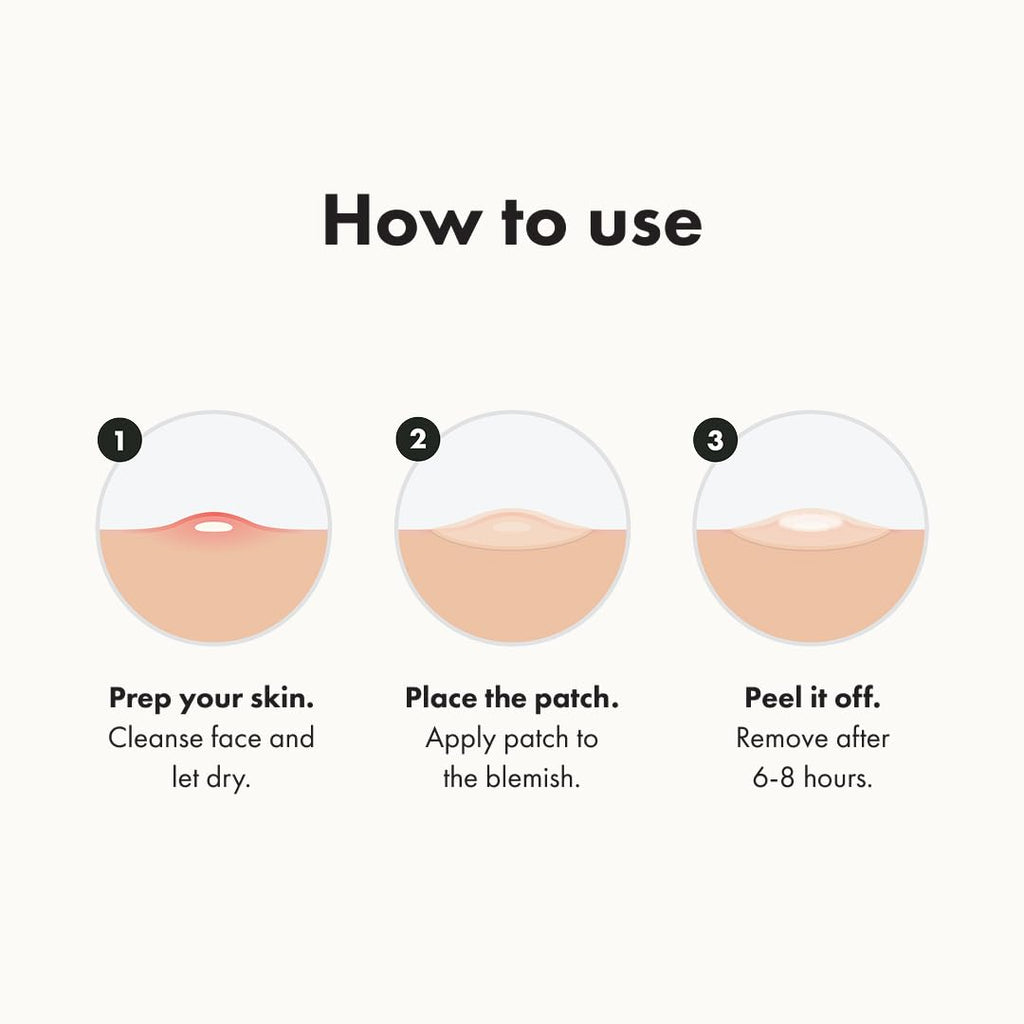 Mighty Patch Original Patch from Hero Cosmetics - #1 Hydrocolloid Acne Pimple Patches for Face, Shrinking Zits & Whiteheads in 1 Use, Nighttime Spot Pimple Stickers for Face, 75 Count (Pack of 2)